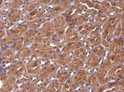 CBWD1 Antibody, Novus Biologicals 0.1mL; Unlabeled:Antibodies, Polyclonal