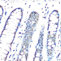 CBX3 Rabbit anti-Human, Mouse, Rat, Clone: 7B7Q2, Novus Biologicals 20