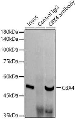 CBX4 Rabbit anti-Human, Mouse, Rat, Clone: 1R5G6, Novus Biologicals 20 &mu;g | Buy Online | Novus Biologicals | Fisher Scientific