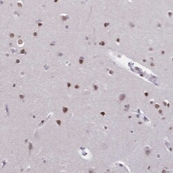 CBX7 Antibody, Novus Biologicals:Antibodies:Primary Antibodies