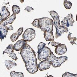 CC Chemokine Receptor D6 Antibody, Novus Biologicals 0.1mL; Unlabeled:Antibodies,