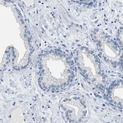 CC Chemokine Receptor D6 Antibody, Novus Biologicals 0.1mL; Unlabeled:Antibodies,