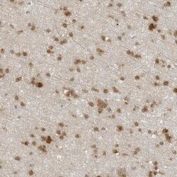 CC2D1B Antibody, Novus Biologicals 25 &mu;L; Unlabeled:Antibodies, Polyclonal