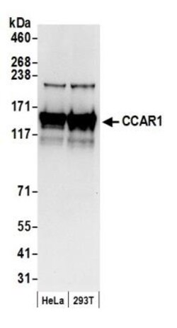 CCAR1 Antibody, Novus Biologicals 0.1mL; Unlabeled:Antibodies, Polyclonal