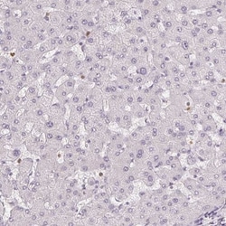 CCDC101 Antibody, Novus Biologicals 25 &mu;L, Unlabeled:Antibodies, Polyclonal