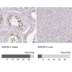 CCDC101 Antibody, Novus Biologicals 25 &mu;L, Unlabeled:Antibodies, Polyclonal
