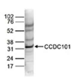 CCDC101 Rabbit anti-Human, Polyclonal, Novus Biologicals 100 &mu;g; Unconjugated:Antibodies,