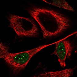 CCDC102A Antibody, Novus Biologicals 25 &mu;L; Unlabeled:Antibodies, Polyclonal
