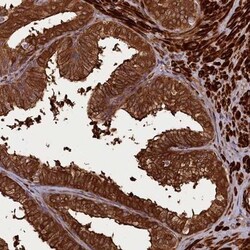 CCDC102A Antibody, Novus Biologicals 0.1mL; Unlabeled:Antibodies, Polyclonal