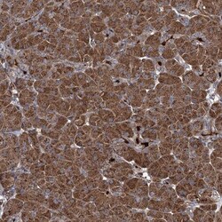 CCDC102A Antibody, Novus Biologicals 25 &mu;L; Unlabeled:Antibodies, Polyclonal
