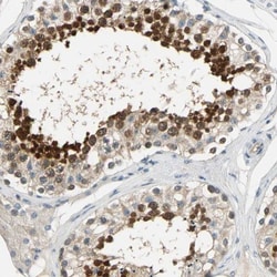 CCDC104 Antibody, Novus Biologicals:Antibodies:Primary Antibodies