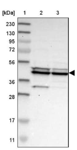 CCDC104 Antibody, Novus Biologicals:Antibodies:Primary Antibodies