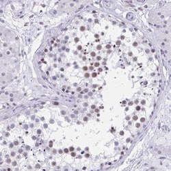 CCDC105 Antibody, Novus Biologicals:Antibodies:Primary Antibodies