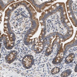 anti-CCDC109A, Polyclonal, Novus Biologicals 0.1 mL | Buy Online | Novus Biologicals | Fisher Scientific