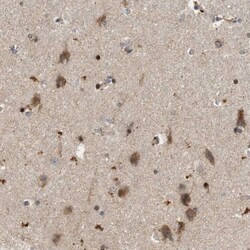 anti-CCDC109A, Polyclonal, Novus Biologicals 0.1 mL | Buy Online | Novus Biologicals | Fisher Scientific