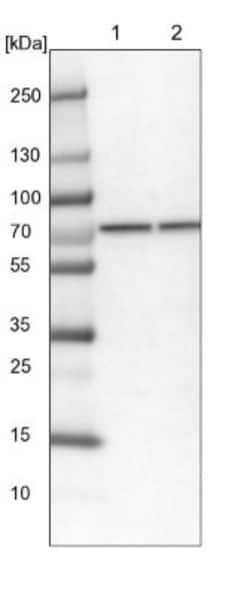 CCDC112 Antibody, Novus Biologicals 0.1mL; Unlabeled:Antibodies, Polyclonal