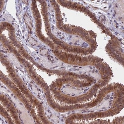 CCDC113 Antibody, Novus Biologicals 0.1mL; Unlabeled:Antibodies, Polyclonal