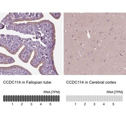 CCDC114 Antibody, Novus Biologicals 0.1mL; Unlabeled:Antibodies, Polyclonal