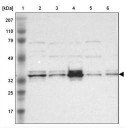 CCDC117 Antibody, Novus Biologicals 25 &mu;L | Buy Online | Novus Biologicals | Fisher Scientific