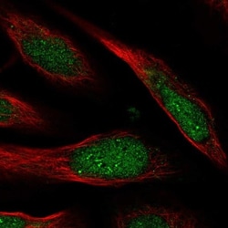 CCDC127 Antibody, Novus Biologicals 25 &mu;L; Unlabeled:Antibodies, Polyclonal