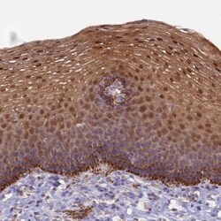 CCDC127 Antibody, Novus Biologicals 25 &mu;L; Unlabeled:Antibodies, Polyclonal