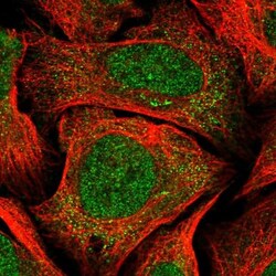CCDC138 Antibody, Novus Biologicals:Antibodies:Primary Antibodies