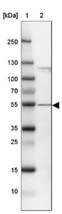 CCDC14 Antibody, Novus Biologicals 0.1mL; Unlabeled:Antibodies, Polyclonal