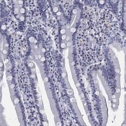 CCDC144A Rabbit anti-Human, Polyclonal, Novus Biologicals 25 &mu;g; Unconjugated:Antibodies,