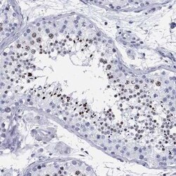 CCDC144A Rabbit anti-Human, Polyclonal, Novus Biologicals 25 &mu;g; Unconjugated:Antibodies,