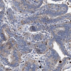 GARS Antibody, Novus Biologicals:Antibodies:Primary Antibodies