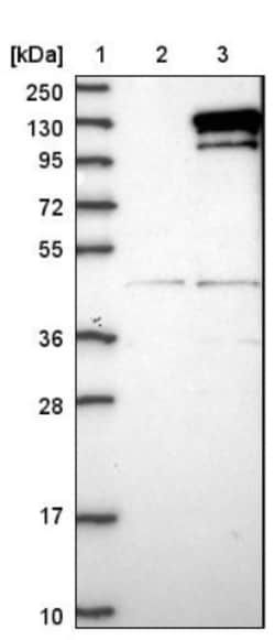 GARS Antibody, Novus Biologicals:Antibodies:Primary Antibodies