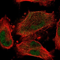 CCDC150 Antibody, Novus Biologicals 25 &mu;L, Unlabeled:Antibodies, Polyclonal