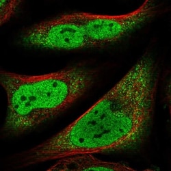 CCDC152 Antibody, Novus Biologicals 0.1mL; Unlabeled:Antibodies, Polyclonal