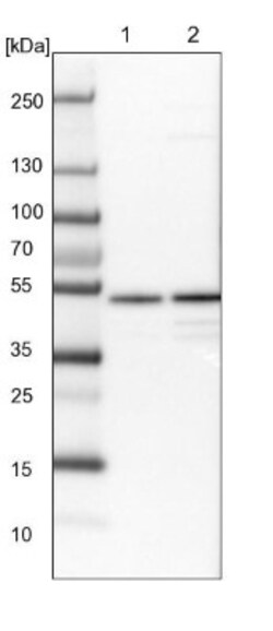 CCDC16 Antibody, Novus Biologicals 0.1mL; Unlabeled:Antibodies, Polyclonal