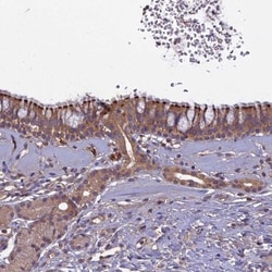 CCDC167 Antibody, Novus Biologicals 0.1mL; Unlabeled:Antibodies, Polyclonal