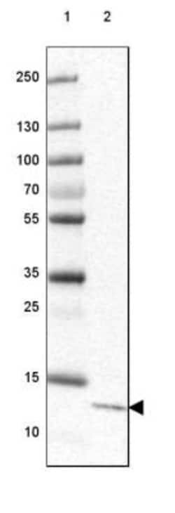 CCDC167 Antibody, Novus Biologicals 0.1mL; Unlabeled:Antibodies, Polyclonal