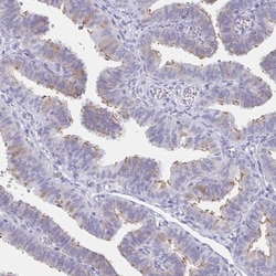 CCDC17 Antibody, Novus Biologicals 0.1mL; Unlabeled:Antibodies, Polyclonal