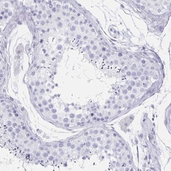 CCDC17 Antibody, Novus Biologicals 0.1mL; Unlabeled:Antibodies, Polyclonal