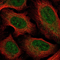 CCDC18 Antibody, Novus Biologicals:Antibodies:Primary Antibodies