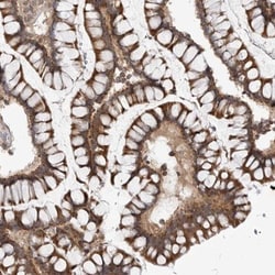 CCDC18 Antibody, Novus Biologicals:Antibodies:Primary Antibodies