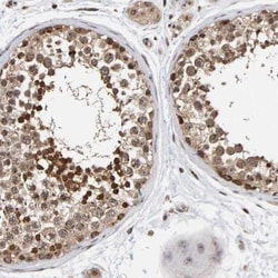 CCDC182 Antibody, Novus Biologicals:Antibodies:Primary Antibodies