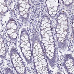 CCDC19 Antibody, Novus Biologicals:Antibodies:Primary Antibodies