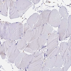 CCDC19 Antibody, Novus Biologicals:Antibodies:Primary Antibodies