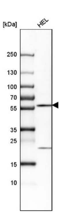 CCDC19 Antibody, Novus Biologicals:Antibodies:Primary Antibodies