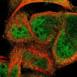 CCDC22 Antibody, Novus Biologicals 0.1mL; Unlabeled:Antibodies, Polyclonal