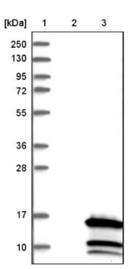 CCDC23 Antibody, Novus Biologicals 0.1mL; Unlabeled:Antibodies, Polyclonal