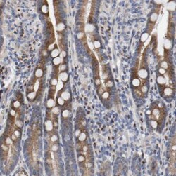 CCDC25 Antibody, Novus Biologicals 0.1mL; Unlabeled:Antibodies, Polyclonal