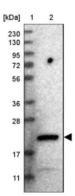 CCDC25 Antibody, Novus Biologicals 0.1mL; Unlabeled:Antibodies, Polyclonal