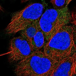 CCDC28A Antibody, Novus Biologicals 0.1mL; Unlabeled:Antibodies, Polyclonal