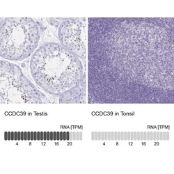 CCDC39 Antibody, Novus Biologicals 0.1mL; Unlabeled:Antibodies, Polyclonal